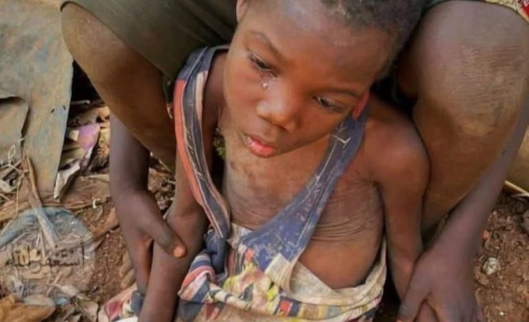 Beri Bantuan dan Harapan untuk Sudan Bersama AMAL!